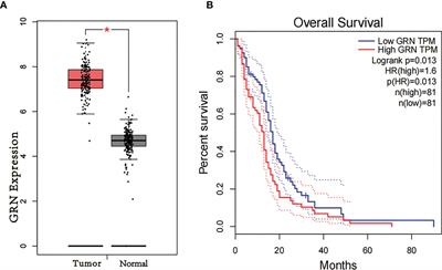 GRN is a prognostic biomarker and correlated with immune infiltration in glioma: A study based on TCGA data